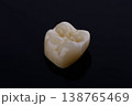 High-quality zirconia dental crown on white background. Dental ceramic crown professional dental lab 138765469