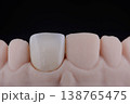 Mirror copy of central maxillary incisor, ultra thin dental ceramic veneer or crown on printed model 138765475