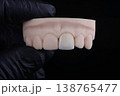 Mirror copy of central maxillary incisor, ultra thin dental ceramic veneer or crown on printed model 138765477