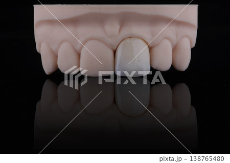 Mirror copy of central maxillary incisor, ultra thin dental ceramic veneer or crown on printed model Mirror copy of central maxillary incisor, ultra thin dental ceramic veneer or crown on printed model 138765480