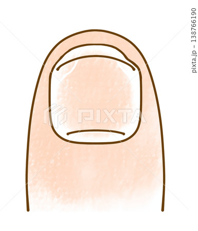 ゆるめシンプルな欠けた爪　アナログ風 138766190