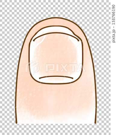 ゆるめシンプルな欠けた爪　アナログ風 138766190