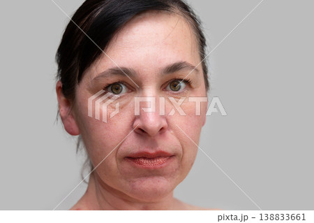 Portrait of a woman close -up with wrinkles and age -related facial changes after forty years 138833661
