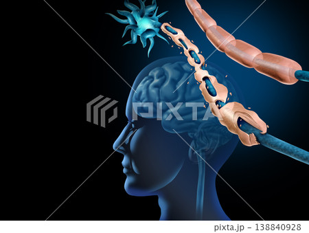 Multiple Sclerosis MS 138840928