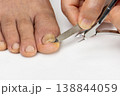 Ingrown toenail on a senior feet with white backgroundClose-up ingrown toenail on senior feet with white background. 138844059