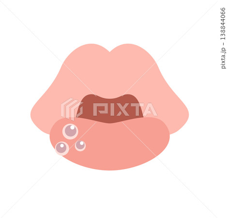 水泡ができた唇 138844066