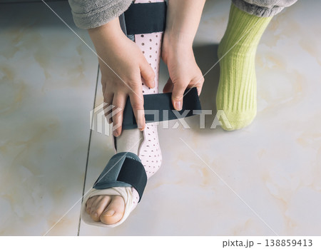Applying a medical leg splint for injury recovery 138859413