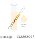 Urine sample test with urinalysis reagent strip  138862097