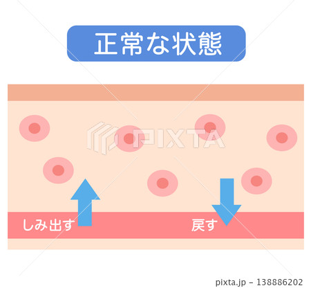 むくみの構造 水分量のバランス 断面図 むくみの構造 水分量のバランス 断面図 138886202
