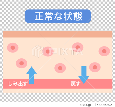 むくみの構造 水分量のバランス 断面図 むくみの構造 水分量のバランス 断面図 138886202