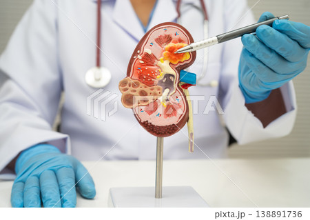 Chronic kidney disease, doctor with model for treatment urinary system, urology, Estimated glomerular filtration rate eGFR. Chronic kidney disease, doctor with model for treatment urinary system, urology, Estimated glomerular filtration rate eGFR. 138891736