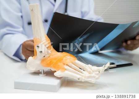 Doctor examining foot ankle joint bone radiography xray film. Doctor examining foot ankle joint bone radiography xray film. 138891738
