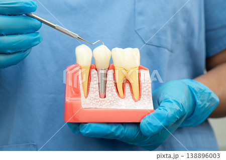Teeth root dental model with tool for dentist use to cleaning care treatment. 138896003