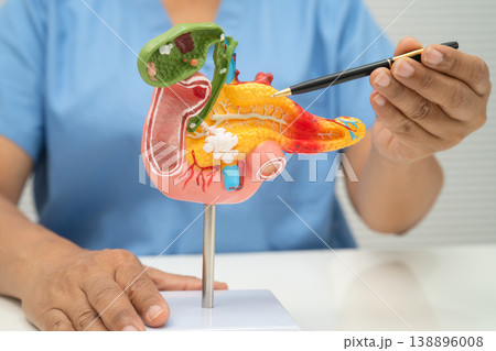 Liver with gallbladder, pancreas spleen and duodenum, Asian doctor holding human anatomy model for study diagnosis and treatment in hospital. 138896008