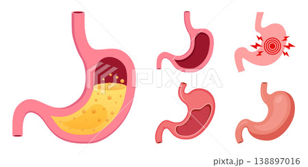 Gerd stomach icon set collection in flat style. Reflux vector illustration on isolated background. Esophageal organ sign business concept. 138897016