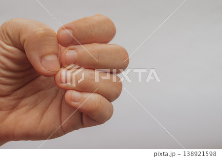 Female hand with bitten short nails and dry cuticles on a white background. Close-up of unkempt fingernails needing professional manicure with large copy space on the right 138921598