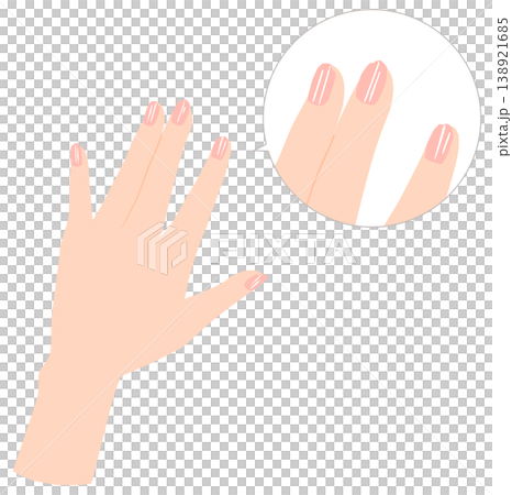 Illustration of damaged fingernails: cracks, chips, vertical lines Illustration of damaged fingernails: cracks, chips, vertical lines 138921685