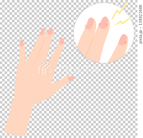 傷んだ手のイラスト　ささくれ 138921686