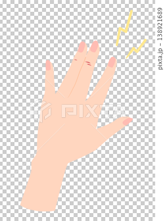 Illustration of damaged hands: chapped, cracked. Illustration of damaged hands: chapped, cracked. 138921689