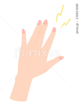傷んだ手のイラスト　ささくれ 138921690