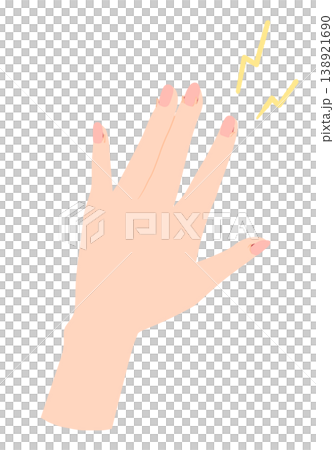 傷んだ手のイラスト　ささくれ 138921690