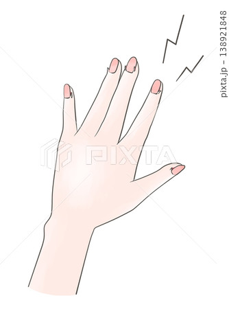 傷んだ手のイラスト　ささくれ 138921848