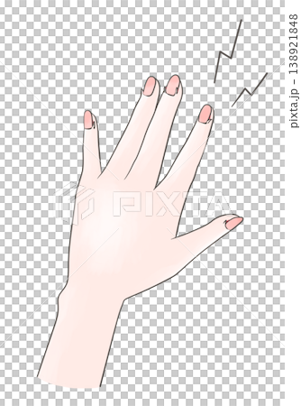 傷んだ手のイラスト　ささくれ 138921848