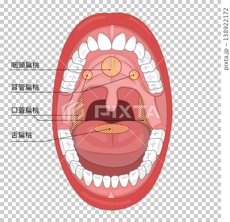 An illustration that clearly shows the inside of an adult's mouth when it is wide open, and the tonsils inside the mouth. 138922172
