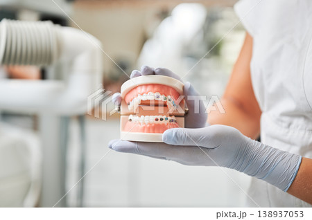Dental specialist presents jaw sample with braces in sterile clinic setting. Detailed orthodontic close up for healthcare promotion, treatment guidance, patient information materials Dental specialist presents jaw sample with braces in sterile clinic setting. Detailed orthodontic close up for healthcare promotion, treatment guidance, patient information materials 138937053