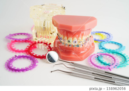 Orthodontic ligatures rings and ties, elastic rubber bands on orthodontic braces, model for dentist studying about dentistry. 138962056