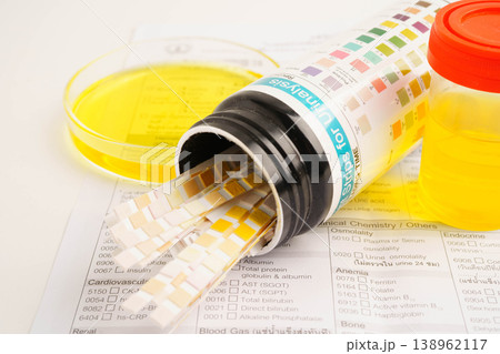 Urinalysis, urine cup with reagent strip pH paper test and comparison chart in laboratory. 138962117