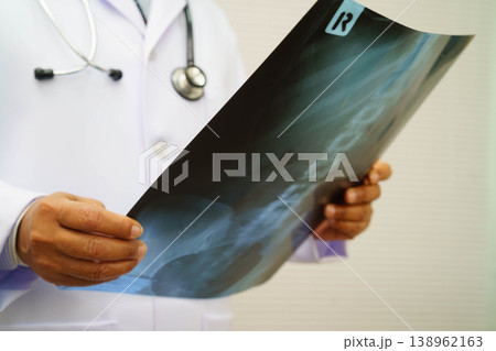 Doctor examining spine bone radiography xray film. Doctor examining spine bone radiography xray film. 138962163
