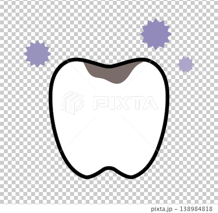 Illustration of a tooth with a cavity, stains, and pain. Illustration of a tooth with a cavity, stains, and pain. 138984818