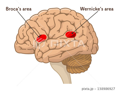 大脳のブローカ野とウェルニッケ野 Broca's area and Wernicke's area 大脳のブローカ野とウェルニッケ野 Broca's area and Wernicke's area 138986927