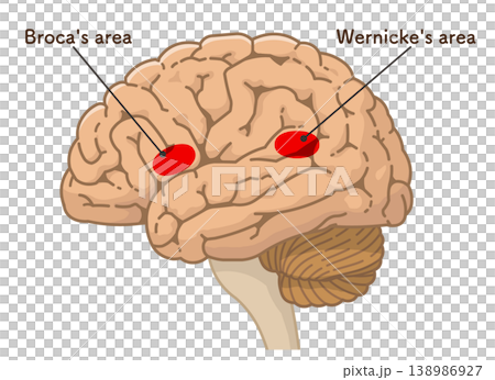 大脳のブローカ野とウェルニッケ野 Broca's area and Wernicke's area 大脳のブローカ野とウェルニッケ野 Broca's area and Wernicke's area 138986927