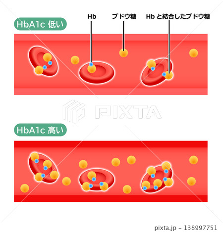 血管の中のHbA1cの状態のイラスト 138997751