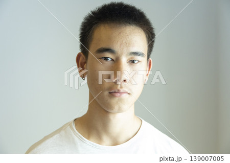 Close up portrait of teen boy face with pimple and acne problem standing on white background. Close up portrait of teen boy face with pimple and acne problem standing on white background. 139007005