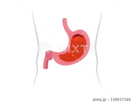 Anatomical Illustration of the Human Stomach with Gastric Acid Inside Anatomical Illustration of the Human Stomach with Gastric Acid Inside 139017168