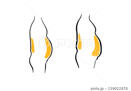 Body mass index  139022878