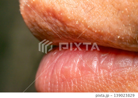 Close up of dry cracked lips and skin texture showing dehydration and health care concept detailed macro of human mouth area natural light Close up of dry cracked lips and skin texture showing dehydration and health care concept detailed macro of human mouth area natural light 139023829