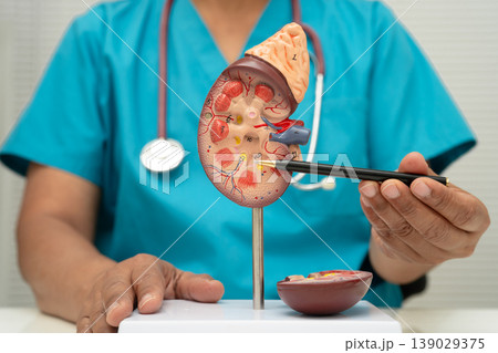 Doctor with kidney model for treatment urinary system. 139029375