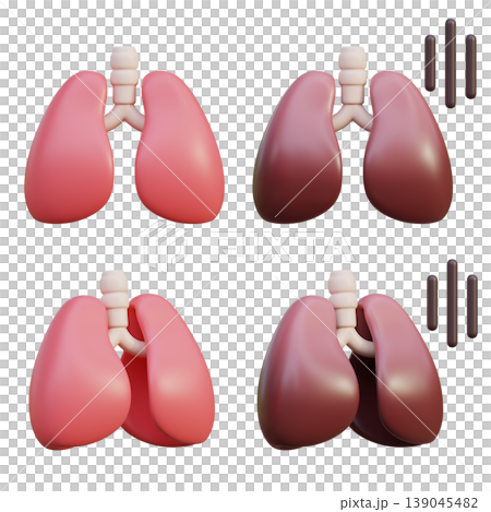 Healthy Lungs and Unhealthy Lungs 3D Illustration Healthy Lungs and Unhealthy Lungs 3D Illustration 139045482