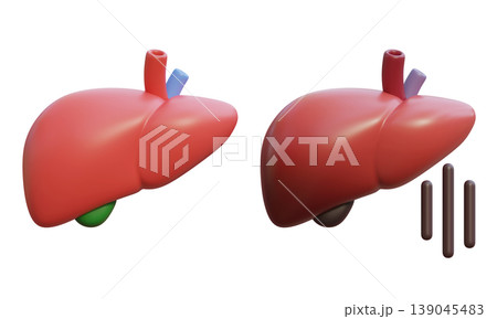 Healthy Liver and Sick Liver 3D Illustration Healthy Liver and Sick Liver 3D Illustration 139045483