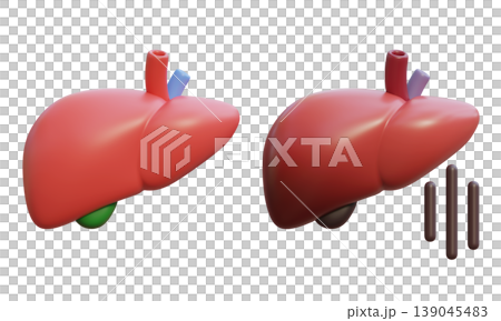 Healthy Liver and Sick Liver 3D Illustration Healthy Liver and Sick Liver 3D Illustration 139045483