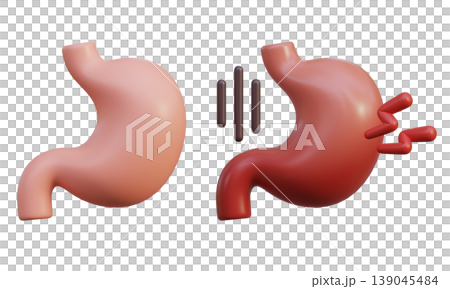 Healthy Stomach and Sick Stomach 3D Illustration Healthy Stomach and Sick Stomach 3D Illustration 139045484