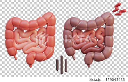 Healthy Intestine and Sick Intestine 3D Illustration 139045486