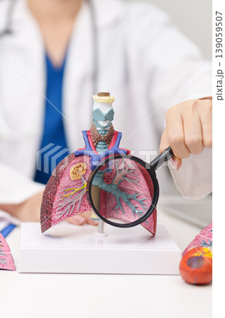 Doctor with Smoker and normal Lung anatomy for Disease. Lung Cancer, Asthma, Chronic Obstructive Pulmonary or COPD, Bronchitis, Emphysema, Cystic Fibrosis, Bronchiectasis, Pneumonia and world Lung day 139059507
