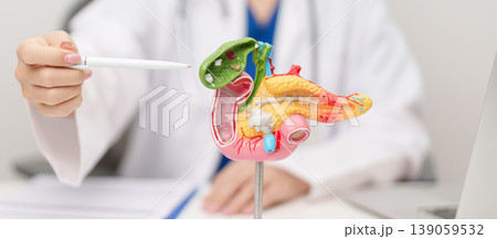 Doctor with human Pancreatitis anatomy model with Pancreas, Gallbladder, Bile Duct, Duodenum, Small intestine. Pancreatic cancer, Acute and Chronic pancreatitis, Digestive system and Health concept 139059532