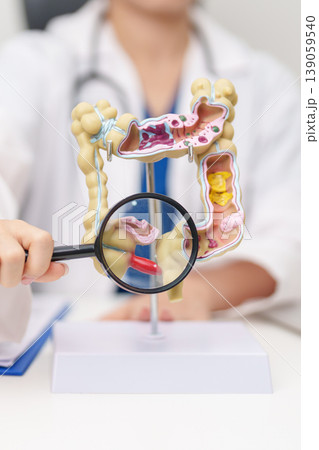 Doctor with human Colon anatomy model. Colonic disease, Large Intestine, Colorectal cancer, Ulcerative colitis, Diverticulitis, Irritable bowel syndrome, Digestive system and Healthcare concept Doctor with human Colon anatomy model. Colonic disease, Large Intestine, Colorectal cancer, Ulcerative colitis, Diverticulitis, Irritable bowel syndrome, Digestive system and Healthcare concept 139059540