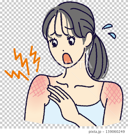 An illustration of a woman who is surprised to notice she has a sunburn (redness, stinging, UV damage). 139060249